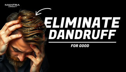 Man with dandruff on his head with text 'Eliminate Dandruff for Good' and 'Mantra' brand logo.