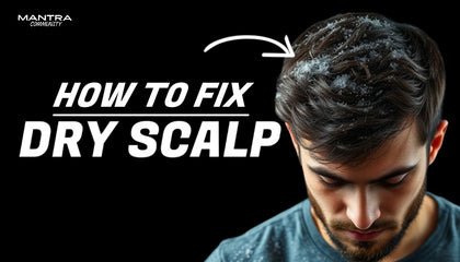 Man with dry scalp looking down, with text 'How to Fix Dry Scalp' and 'Mantra' brand name.